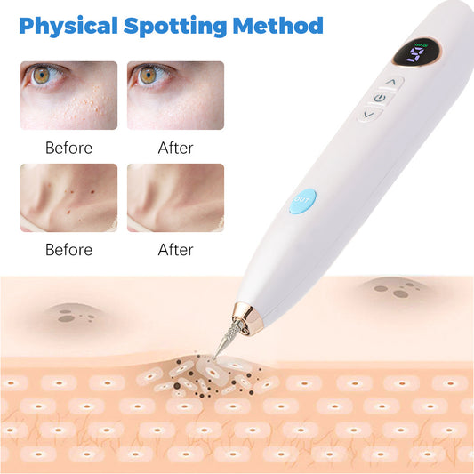Plasma Remove Scar Black Spot Face Wart Tattoo Device